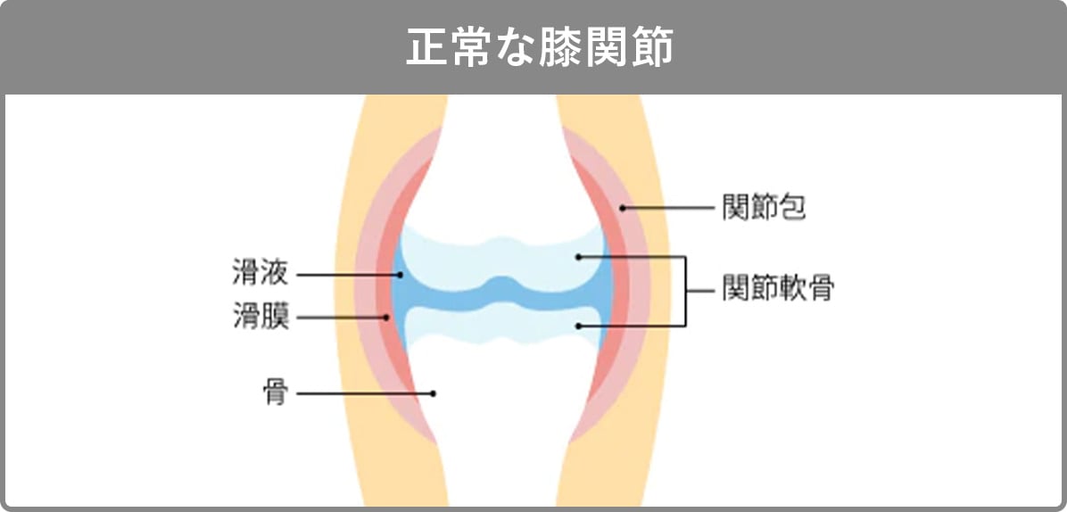 正常な膝関節