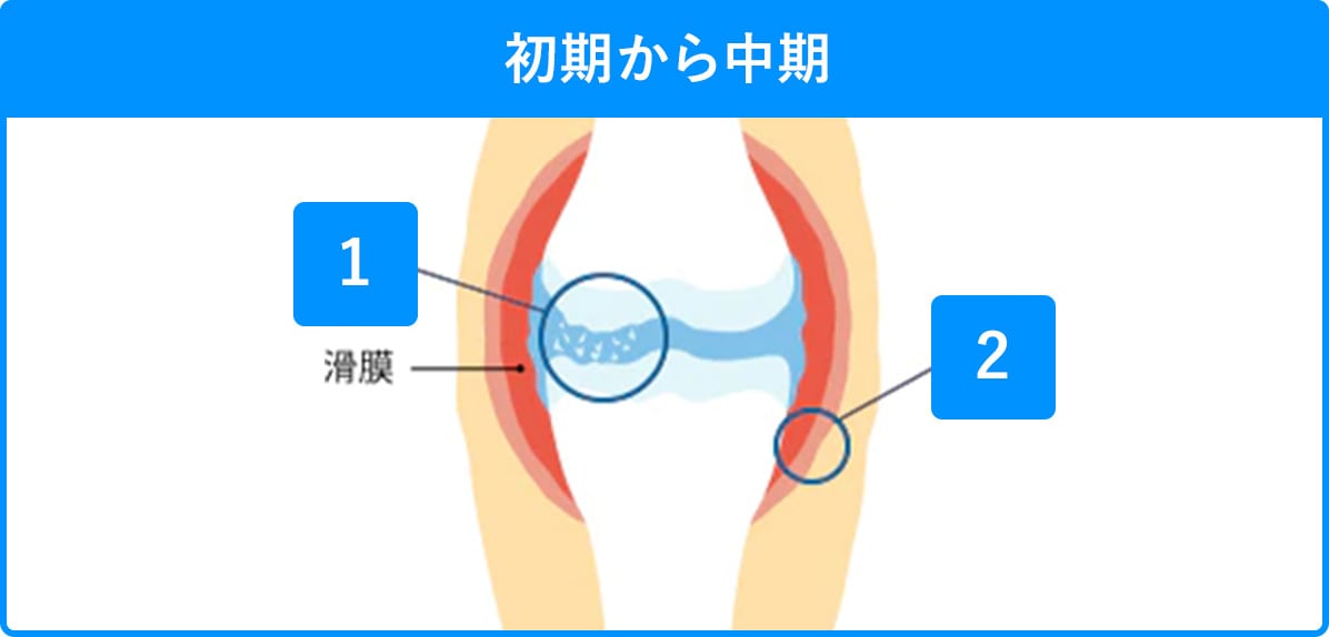 初期から中期